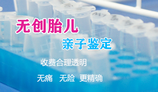 石家庄孕期亲子鉴定机构结果需要多久,石家庄孕期亲子鉴定在哪个地方做 石家庄孕期亲子鉴定机构结果需要多久,石家庄孕期亲子鉴定在哪个地方做